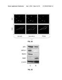 Compositions and Methods of Treatment of Cancers diagram and image