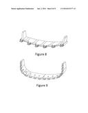 Rolled and Folded Lip and Manufacturing Method Thereof diagram and image