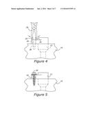 ENGINE COVER HAVING A RETAINER TO SECURE AN ENGINE ACCESSORY diagram and image