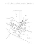 Support Device diagram and image