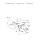 Universal Bedside Holster Assembly diagram and image