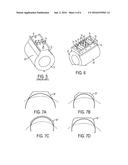 Enhanced Track Resistant Dome Structure For Dry-Type Cast Coil Transformer diagram and image