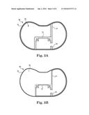 IMPLANTABLE MEDICAL DEVICE HOUSING HAVING INTEGRATED FEATURES diagram and image