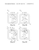 IMPLANTABLE MEDICAL DEVICE HOUSING HAVING INTEGRATED FEATURES diagram and image