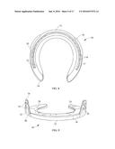 HORSESHOE WITH CLIPS, BLISTER MEMBER FOR A CLIP, AND METHOD OF APPLYING     SHOE TO A HORSE S HOOF diagram and image