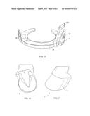 HORSESHOE WITH CLIPS, BLISTER MEMBER FOR A CLIP, AND METHOD OF APPLYING     SHOE TO A HORSE S HOOF diagram and image