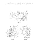 HORSESHOE WITH CLIPS, BLISTER MEMBER FOR A CLIP, AND METHOD OF APPLYING     SHOE TO A HORSE S HOOF diagram and image