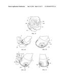 HORSESHOE WITH CLIPS, BLISTER MEMBER FOR A CLIP, AND METHOD OF APPLYING     SHOE TO A HORSE S HOOF diagram and image