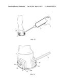 HORSESHOE WITH CLIPS, BLISTER MEMBER FOR A CLIP, AND METHOD OF APPLYING     SHOE TO A HORSE S HOOF diagram and image