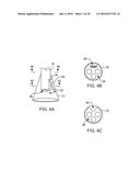 Systems And Methods For Unobstructed Visualization And Ablation diagram and image