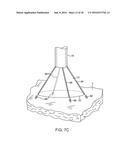 Systems And Methods For Unobstructed Visualization And Ablation diagram and image