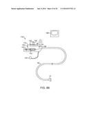 Systems And Methods For Unobstructed Visualization And Ablation diagram and image