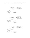 Systems And Methods For Unobstructed Visualization And Ablation diagram and image