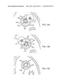 Systems And Methods For Unobstructed Visualization And Ablation diagram and image