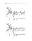 Systems And Methods For Unobstructed Visualization And Ablation diagram and image