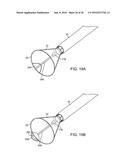 Systems And Methods For Unobstructed Visualization And Ablation diagram and image