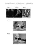 FEET POSITIONING SYSTEM FOR MAGNETIC RESONANCE IMAGING STUDIES diagram and image