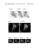 FEET POSITIONING SYSTEM FOR MAGNETIC RESONANCE IMAGING STUDIES diagram and image