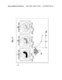 FLUORESCENCE OBSERVATION DEVICE, ENDOSCOPIC SYSTEM, PROCESSOR DEVICE, AND     OPERATION METHOD diagram and image