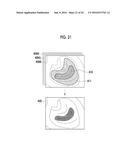 FLUORESCENCE OBSERVATION DEVICE, ENDOSCOPIC SYSTEM, PROCESSOR DEVICE, AND     OPERATION METHOD diagram and image