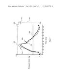 DEVICES, SYSTEMS, AND METHODS FOR DETECTING ANOMALOUS CARDIAC WAVEFORMS     AND MAKING PHYSIOLOGIC MEASUREMENT CALCULATIONS diagram and image