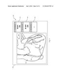 AUTOMATED IDENTIFICATION AND CLASSIFICATION OF INTRAVASCULAR LESIONS diagram and image