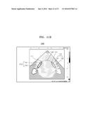 ULTRASOUND METHOD AND APPARATUS FOR PROCESSING ULTRASOUND IMAGE diagram and image