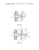 FISTULA TREATMENT DEVICES AND RELATED METHODS diagram and image