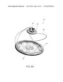 FISTULA TREATMENT DEVICES AND RELATED METHODS diagram and image