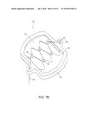 FISTULA TREATMENT DEVICES AND RELATED METHODS diagram and image