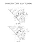 FISTULA TREATMENT DEVICES AND RELATED METHODS diagram and image