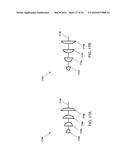 FISTULA TREATMENT DEVICES AND RELATED METHODS diagram and image