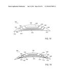 FISTULA TREATMENT DEVICES AND RELATED METHODS diagram and image