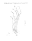 FISTULA TREATMENT DEVICES AND RELATED METHODS diagram and image