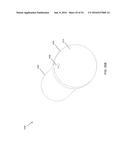 FISTULA TREATMENT DEVICES AND RELATED METHODS diagram and image