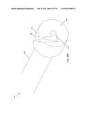 FISTULA TREATMENT DEVICES AND RELATED METHODS diagram and image