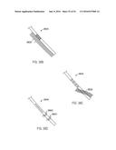 FISTULA TREATMENT DEVICES AND RELATED METHODS diagram and image