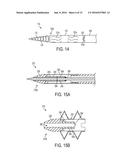 Devices and Methods for Occluding or Promoting Fluid Flow diagram and image