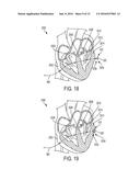 Devices and Methods for Occluding or Promoting Fluid Flow diagram and image