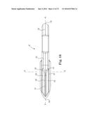 METHOD OF FIXATING AN IMPLANTABLE MATERIAL IN A PATIENT diagram and image