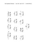 METHOD OF FIXATING AN IMPLANTABLE MATERIAL IN A PATIENT diagram and image