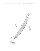 METHOD OF FIXATING AN IMPLANTABLE MATERIAL IN A PATIENT diagram and image