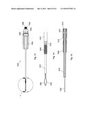 IMPLANT PLACEMENT SYSTEMS, DEVICES AND METHODS diagram and image