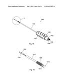 IMPLANT PLACEMENT SYSTEMS, DEVICES AND METHODS diagram and image