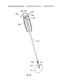 IMPLANT PLACEMENT SYSTEMS, DEVICES AND METHODS diagram and image