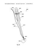 IMPLANT PLACEMENT SYSTEMS, DEVICES AND METHODS diagram and image