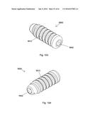 IMPLANT PLACEMENT SYSTEMS, DEVICES AND METHODS diagram and image