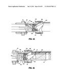 SURGICAL STAPLING APPARATUS diagram and image