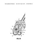 SURGICAL STAPLING APPARATUS diagram and image