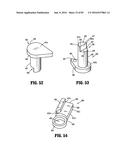 SURGICAL STAPLING APPARATUS diagram and image